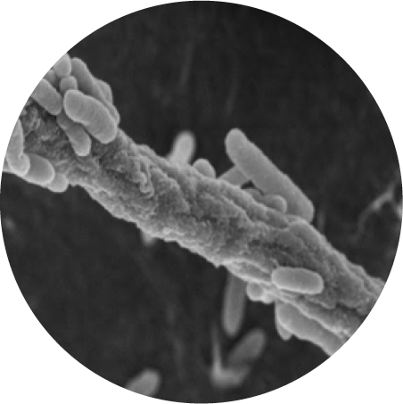 Microscopic image of dark septate endophyte (DSE), a microorganism that colonizes the roots of plants.