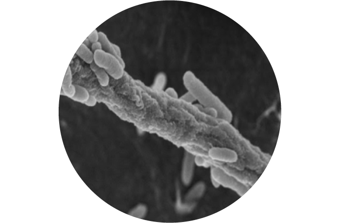 Microscopic image of dark septate endophyte (DSE), a microorganism that colonizes the roots of plants.